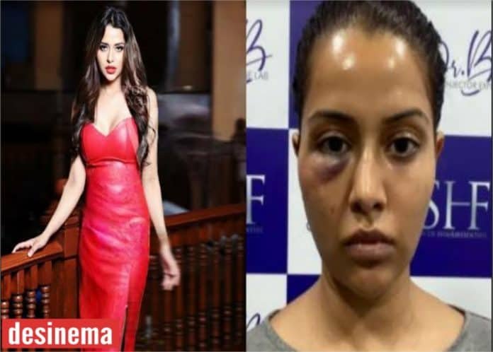 Tamil Actress Raiza Wilson seeks 1 crore compensation from her dermatologist over wrong surgery