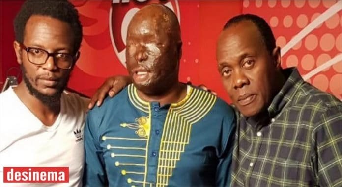 My wife poured acid on my face while I was asleep ex police officer shares painful story