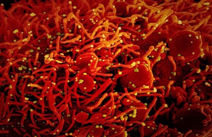 coronavirus.