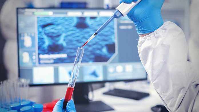 Ukraine-labs-working-on-agents-of-plague-anthrax-as-part-of-US-led-biological-programme-Russia