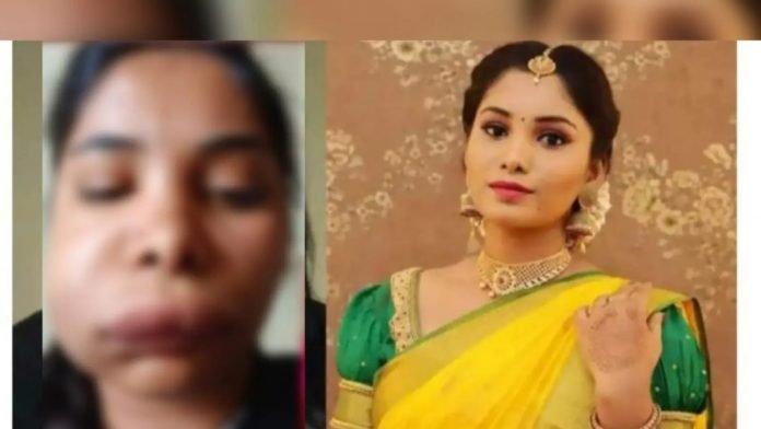 Kannada-actress-Swathis-face-gets-horribly-swollen-after-root-canal-op-goes-wrong
