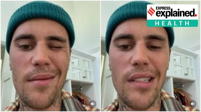 Arshi-Khan-slams-Munawar-for-tweet-on-Justin-Biebers-facial-paralysis