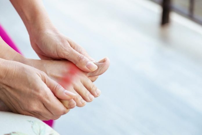 Gout-flare-ups-may-up-heart-attack-stroke-risk-for-upto-120-days-Study